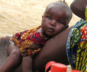 Evacuation of malnourished children from Bama, Borno State