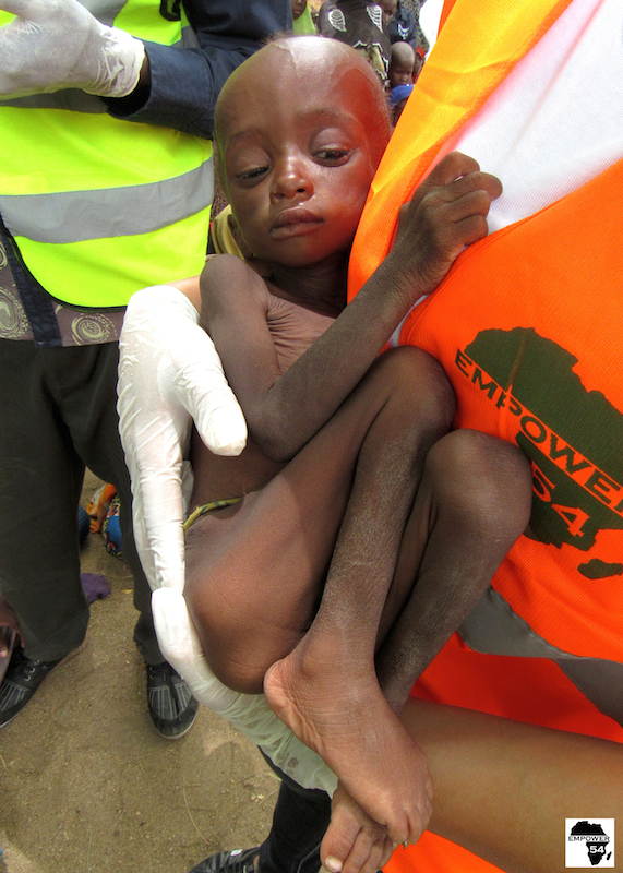 Malnourished Children of Bama Evacuation (3)